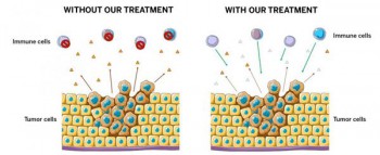 NÓNG: sử dụng enzyme chữa ung thư – bước đột phá vĩ đại